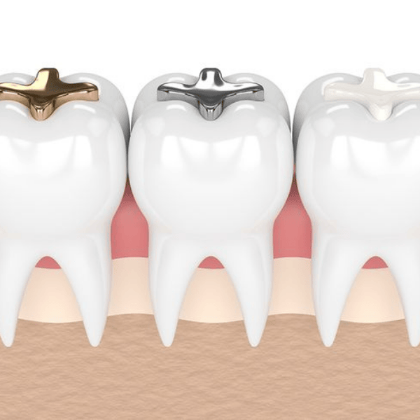 Teeth Replacement Image